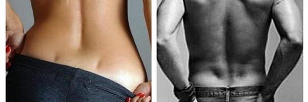 Kas Teil on alaseljal väiksed lohukesed? Kui on, siis loe mida see tähendab.