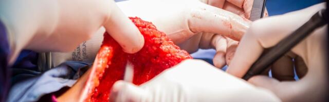 Sihtmärkravi kasutuselevõtt on oluline samm rinnavähi ravis