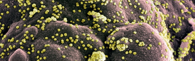 SUUR ÜLEVAADE | Eestlasi viimastel aastatel enim tapnud viirused ja bakterid