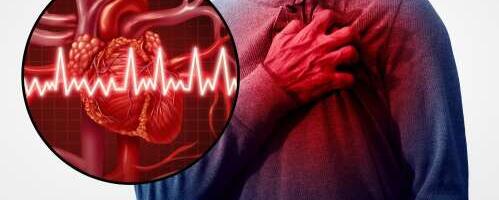 Mis tõstab infarktiohtu?