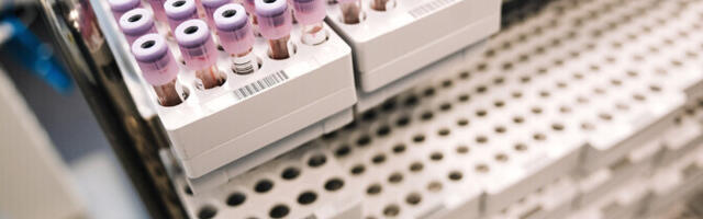 Synlab langetas tervisekassa kärpe tõttu laboriteenuste hindu