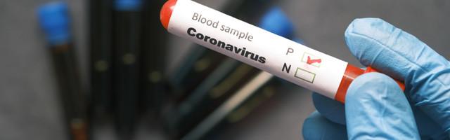 Koroonaviirus Eestis, 22. mai 2021: ööpäevaga lisandus 180 positiivset, suri 1 inimene