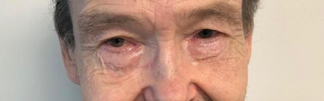 Politsei otsib Tartumaal kadunud Manfredi