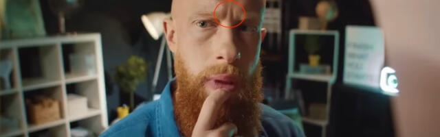 Millise inimolendiga on tegemist, kellel tugevad nahavoldid kahe kulmu vahel