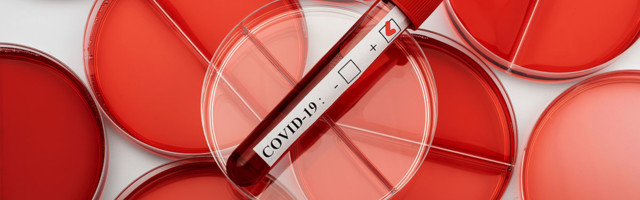 Koroonaviirus Eestis, 26. juuli 2021: ööpäevaga lisandus 66 positiivset