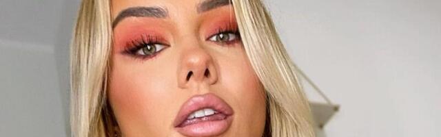 “RANNAMAJA” ADA paljastas, milline ta tegelikult pärast kaloripõletust välja näeb