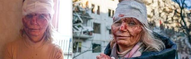 Haavatud Ukraina õpetaja Olena Kurilo on lõpuks ohutus kohas