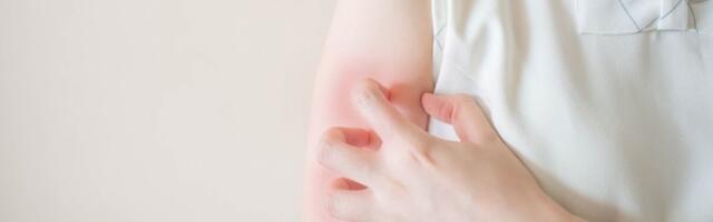 Psoriaasipatsiendi raviteekond on parandamisel