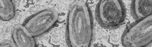 Hetkeseis ahvirõugetest maailmas: kaks uut surmajuhtumit