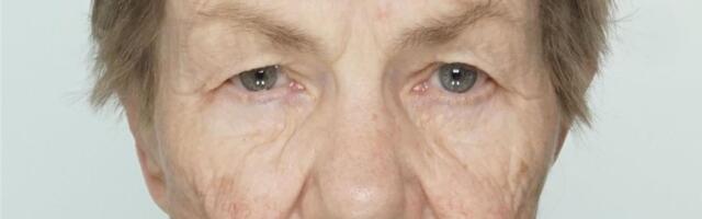 Politsei otsib Tartu linnas kadunud 73-aastast Õilmet