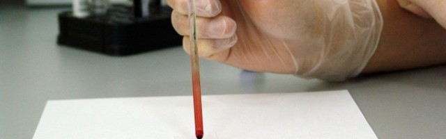 Uus bioandur tuvastab COVID-19-antikehi vaid sekunditega