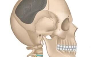 Atlanta haiglas läks operatsiooni käigus kaduma osa patsiendi koljust