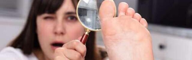 Kuidas vabaneda naha- ja küüneseenest?