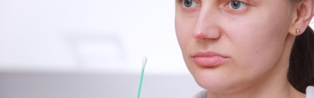 HAKKA KIIRESTI RAVIMA! Ohatise vastu on tõhusad need kreemid