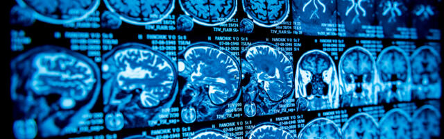 Yale’i ülikooli emeriitprofessor: Oleme viimase kahe aasta jooksul tunnistajaks vähipandeemiale, millelaadset pole varem kogetud