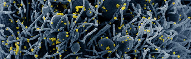 VÄRSKE UURING | COVID-19 ei levi sugulisel teel