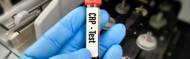 Väitekiri: vaikne põletik ennustab südame-veresoonkonna haigusi ja suremust