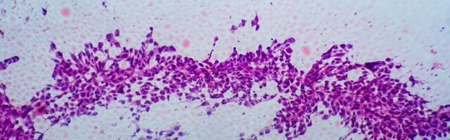 UURING: vähiravi toime võib sõltuda selle saamise kellaajast