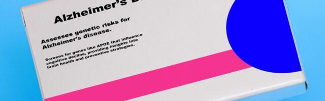 Uuring: suurem lihatarbimine võib vähendada Alzheimeri riski