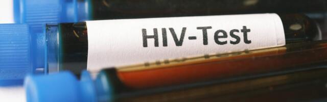 Tervise Arengu Instituut kutsub inimesi üles HIV-testima