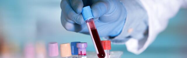 Selgusid tervist enim kahjustavad stressifaktorid