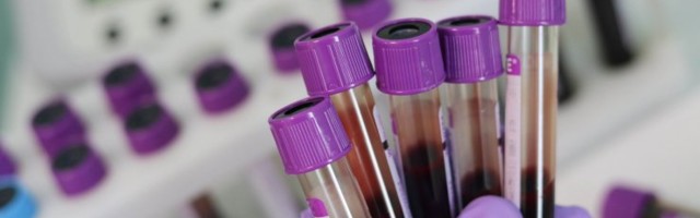 Uudne vereanalüüs tuvastab vähktõbe isegi neli aastat enne haigustunnuste ilmnemist