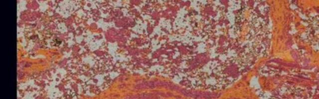 Jõudeklassi raske töö