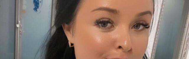 DIANA TENISTE paljastas, kuidas botoxi süstimine aknele tegelikult mõjub