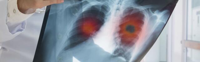 Vähitõrje tegevuskavast ja rakenduskavast