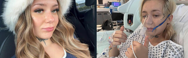 Inglise tüdruk sai veipimisest 21-aastaselt 3. astme vähi