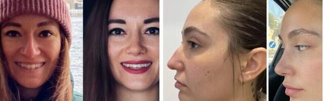 Turvaline ninaplastika Istanbulis