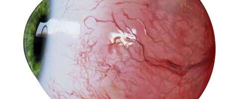 Kuidas me üldse näeme?