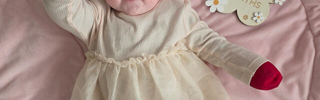 Palun aita kuuekuusel Emmal valuvabalt elada – ülikarmi nahka haarava geenihaigusega pisitüdruku ravi jätkamiseks on vaja 142 000 eurot