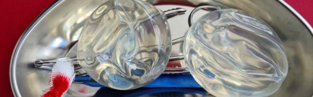 TÄHESEISUD ⟩ Elame võltsilu ajastul: millal ja miks tasuks vältida ilulõikusi?