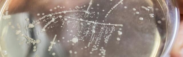 Vaata, millistest kohtadest eelmisel aastal kõige rohkem salmonellat ja listeriat leiti