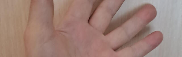 ÄRA RIKU TEADMATUSEST OMA NAHA NÄHTAMATUT KAITSEKIHTI!