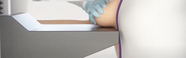 Mammograafia sõeluuring on kahjulik ja sellest tuleks loobuda