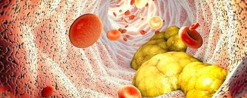 Perekondlik hüperkolesteroleemia kandub vanematelt lastele