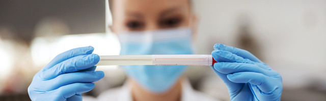 Koroonaviiruse statistika Eestis, 24. juuni 2021: ööpäevaga lisandus 18 positiivset