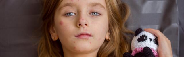 WHO: leetrijuhtumite arv on 24 aastaga tänu vaktsineerimisele vähenenud 71%