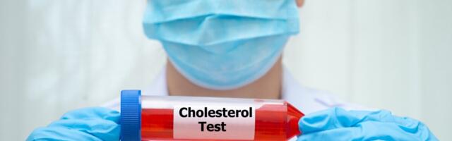 Uuring: Geeniteraapia võib alandada kolesteroolitaset püsivalt