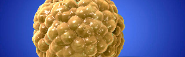 Energiapuudus on ülekaalulisuse põhiprobleem