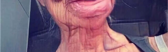 Vananemine kiireneb hüppeliselt 50. eluaasta paiku