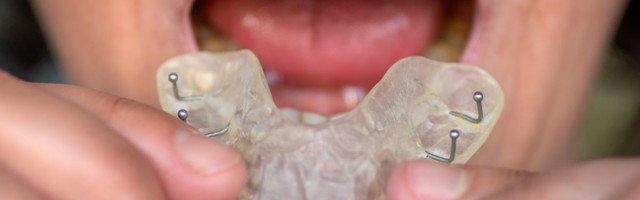 Uuring: koroonaaeg paneb hambaid krigistama ja lõua valutama