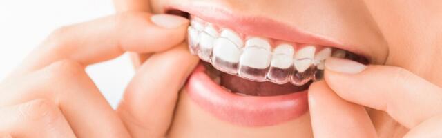 Ortodondid keelduvad hambaarstide koostööpakkumisest