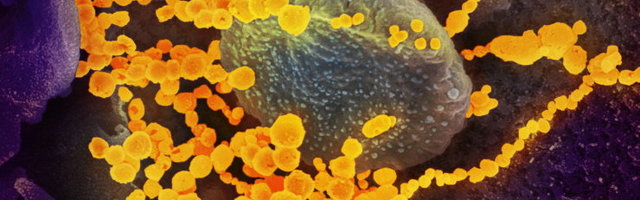 Tartu Ülikooli teadlased töötasid välja COVID-19 testi