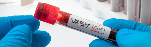 Husi uuring: koroonainfektsioone oli ametlikes andmetes toodust tunduvalt rohkem