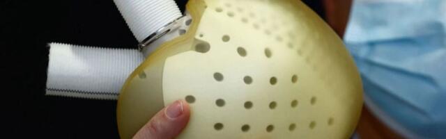 CARMAT' tehissüda suunati kliinilisse uuringusse