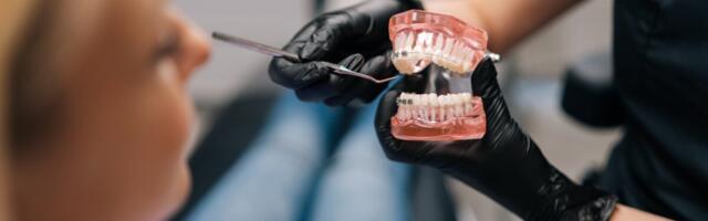 Konkurentsiameti hinnangul on Eestis ortodontiateenuste alapakkumine