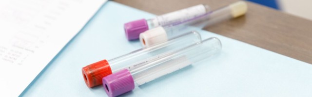 Endokriinhaiguste korral kulgeb COVID–19 raskelt